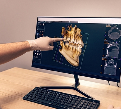 Рентген челюсти