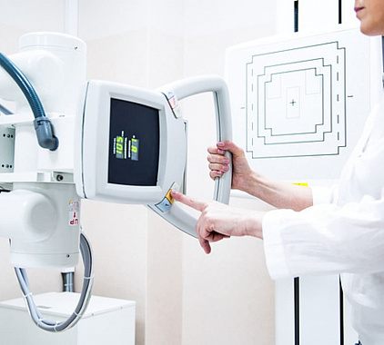 Рентген пищевода с барием Рентген пищевода с барием