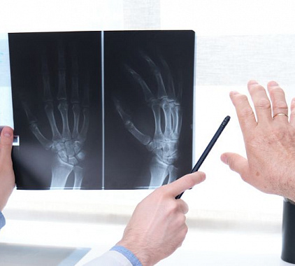 Рентген кисти