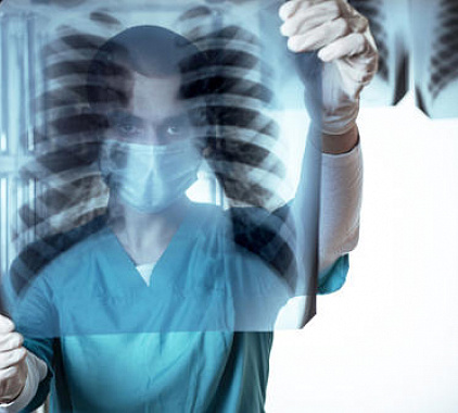 Рентген ребер