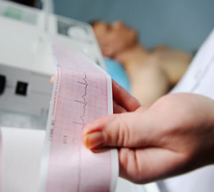Подготовка к ЭКГ