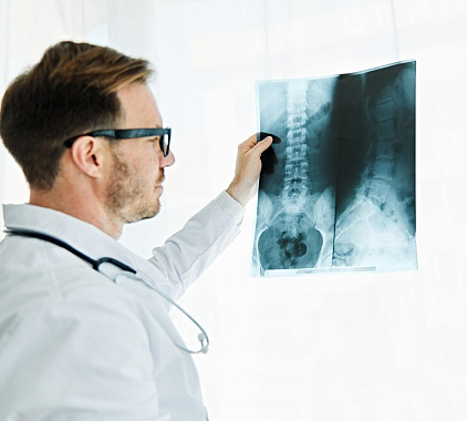 Рентген таза Рентген таза