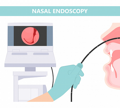 Эндоскопия носа