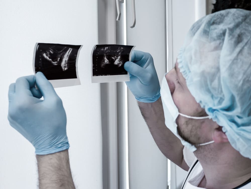 Импотенция у мужчин – признаки, симптомы, причины, виды, диагностика и ...