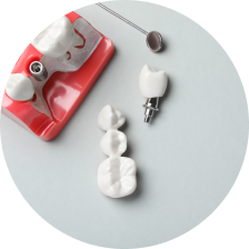 Протез на мини-имплантах Протез на мини-имплантах