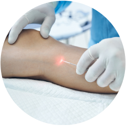 Результат ЭВЛК