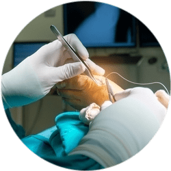 Результат SCARF-остеотомии Результат SCARF-остеотомии