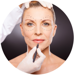 Результат операции Результат блефаропластики