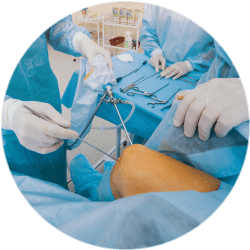 Результат операции по пластике связок коленного сустава