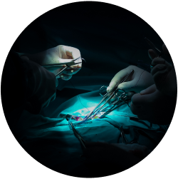 Восстановление после удаления кондилом