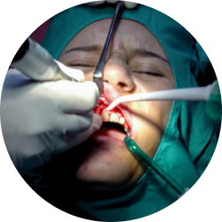 Цистотомия