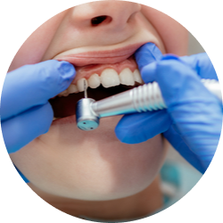 Изъятие корня посредством бормашины