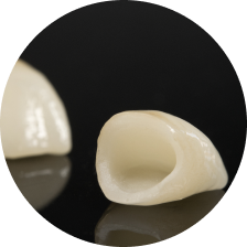 Multi-Layer (монолитные многослойные) коронки