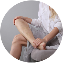 Результат операции Результат пенной склеротерапии