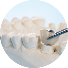 Коронки из металлопластмассы