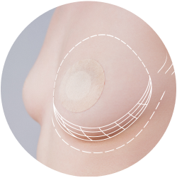 Реабилитация после коррекции сосково-ареолярного комплекса Восстановление после коррекции сосково-ареолярного комплекса
