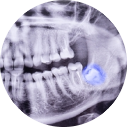 Сложное удаление