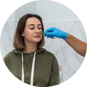 Результат ресептопластики носа