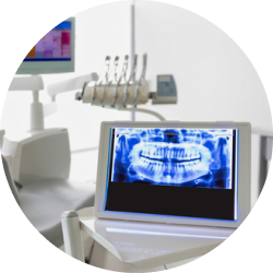 Лазерное удаление кисты зуба