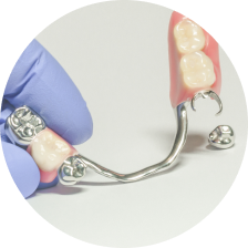 Металлический протез