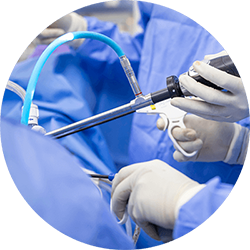 Результат эндопротезирования тазобедренного сустава Результат эндопротезирования тазобедренного сустава