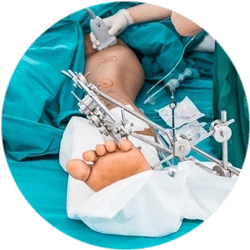 Результат операции по удалению экзостоза Результат операции по удалению экзостоза