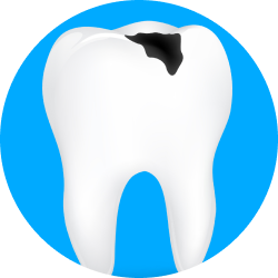 Лечение на стадии разрушения эмали