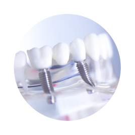 Мостовидный протез