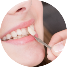 Металлокерамические коронки Металлокерамические коронки