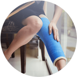 Гипсовая иммобилизация ноги Результат остеосинтеза бедренной кости