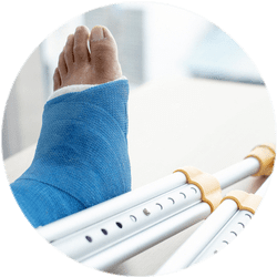 Гипсовая иммобилизация после остеосинтеза плюсневой кости Реабилитация и восстановление после остеосинтеза плюсневой кости стопы