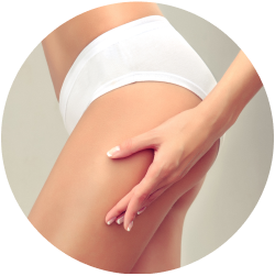 Результат феморопластики