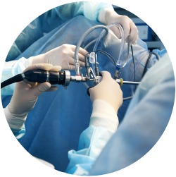 Восстановление после установки стента в мочеточнике