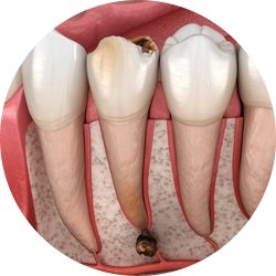 Примордиальная киста