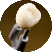 Монолитные коронки