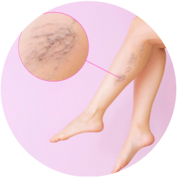 Результат операции Результат кроссэктомии