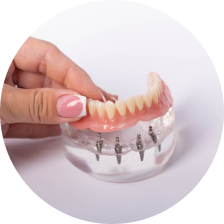Съемные протезы на шаровидных абатментах Съемные протезы на шаровидных абатментах