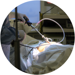 Результат после женской стерилизации