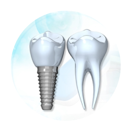 Импланты Straumann Импланты Straumann