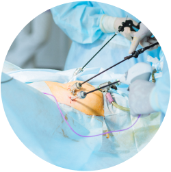 Восстановление после нефрэктомии почки