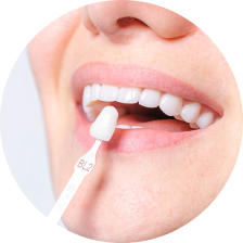 Цельнокерамические коронки