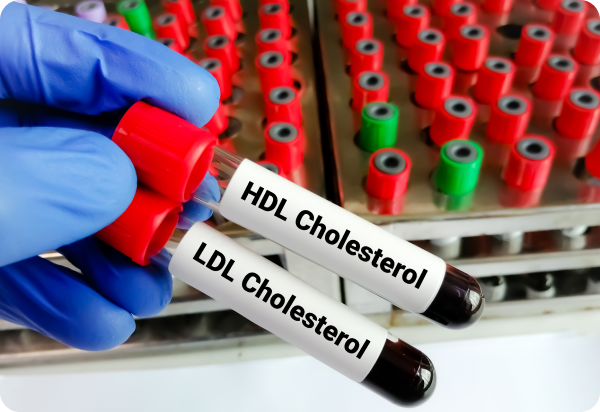 Консультация липидолога Консультация липидолога