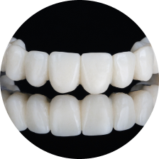 Мостовидные протезы из оксида алюминия
