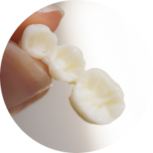 Вкладки из прессованной керамики