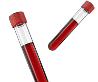 Анализы Анализы