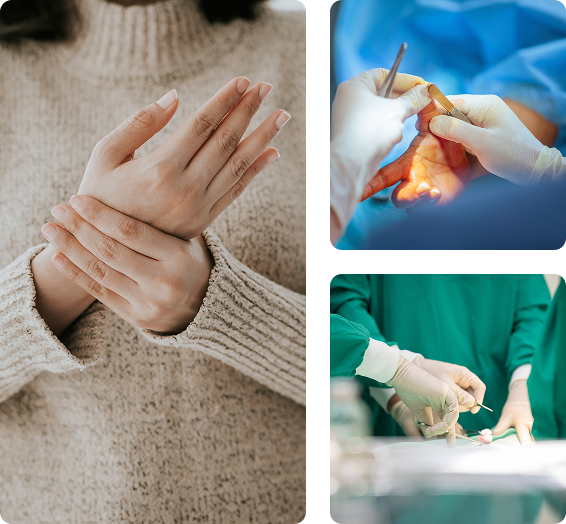 Поводы обращения к кистевому хирургу