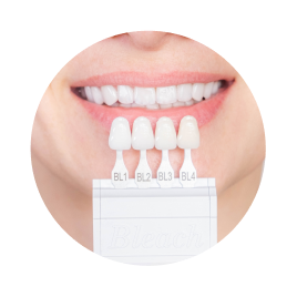 Коронки на передние зубы Коронки на передние зубы