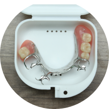 Частичный пластиночный протез