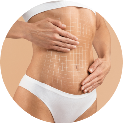 Восстановление после миниабдоминопластики