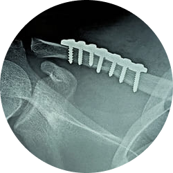 Результат операции и возможные осложнения